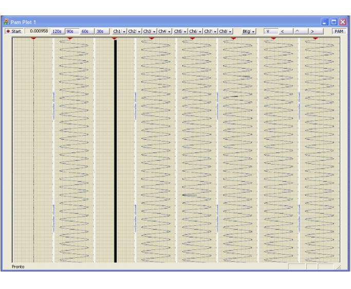 Strip-chart display
