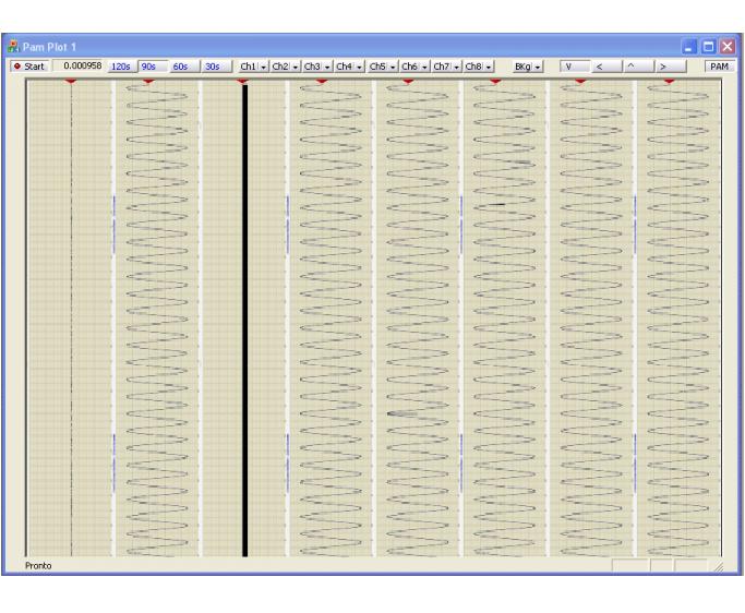 Strip-chart display